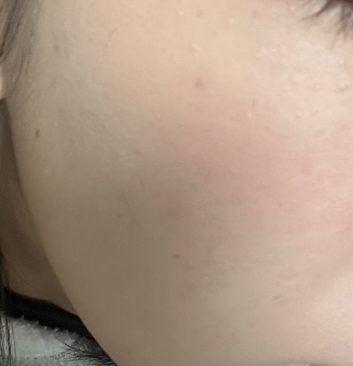 どっちも無加工のすっぴんなんだけど
結構肌荒れしがちでここまできれいになるの頑張った。

#美容垢さんと繋がりたい 
#垢抜けたい