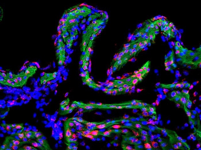 Biomedical Picture of the Day BPoD tweet media