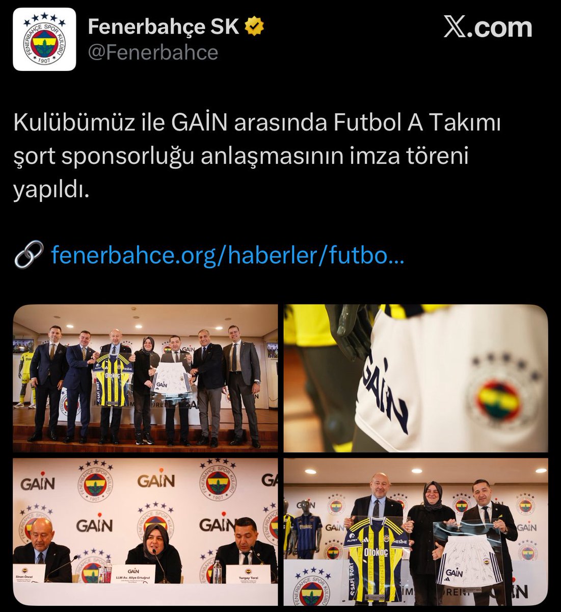 kerem saç kaybı (@keremsackaybii) on Twitter photo 