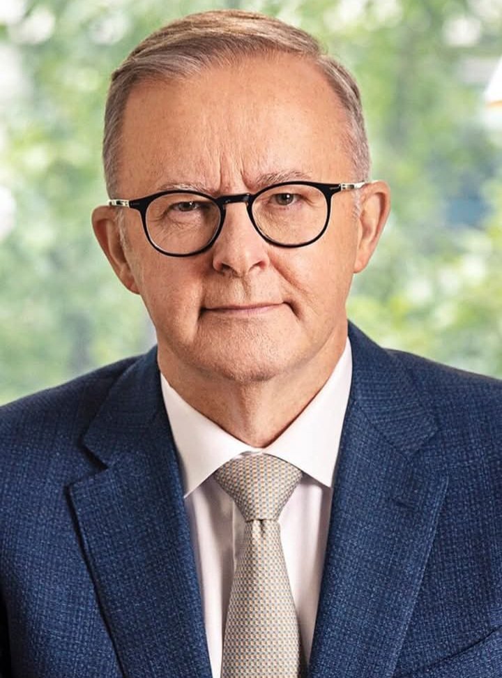 You have blood on your hands Albanese, fucking traitor.