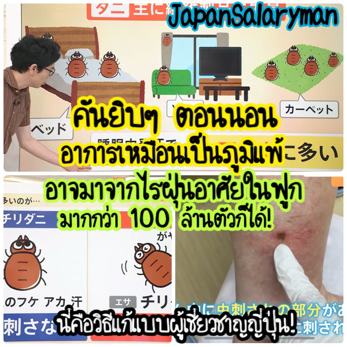 JapanSalaryboom's tweet image. น่ากลัวมาก!รายการญี่ปุ่นเตือนภัยเงียบที่อาจอยู่ในฟูกนอนเรา ถ้าไม่ดูแลให้ดีฟูกนอนเรา อาจมีไรฝุ่นกว่า 100 ล้านตัวก็ได้นะ

และถ้ามันเพิ่มจำนวนมากเกินไป จะดึงดูด “ไรอีกชนิด” ที่กินมันเป็นอาหารและตัวนั้นแหละที่กัดคนด้วย😱 ใครนอนแล้วรู้สึกคันยิบๆ ตื่นมาอาการเหมือนภูมิแพ้ควรอ่านเธรดนี้