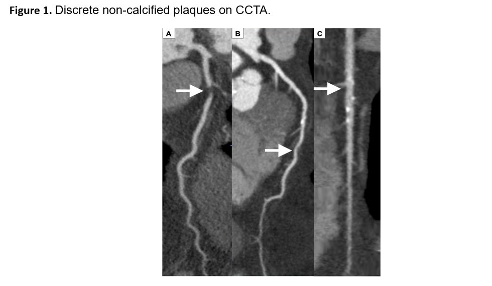 Journal of Cardiovascular CT tweet media