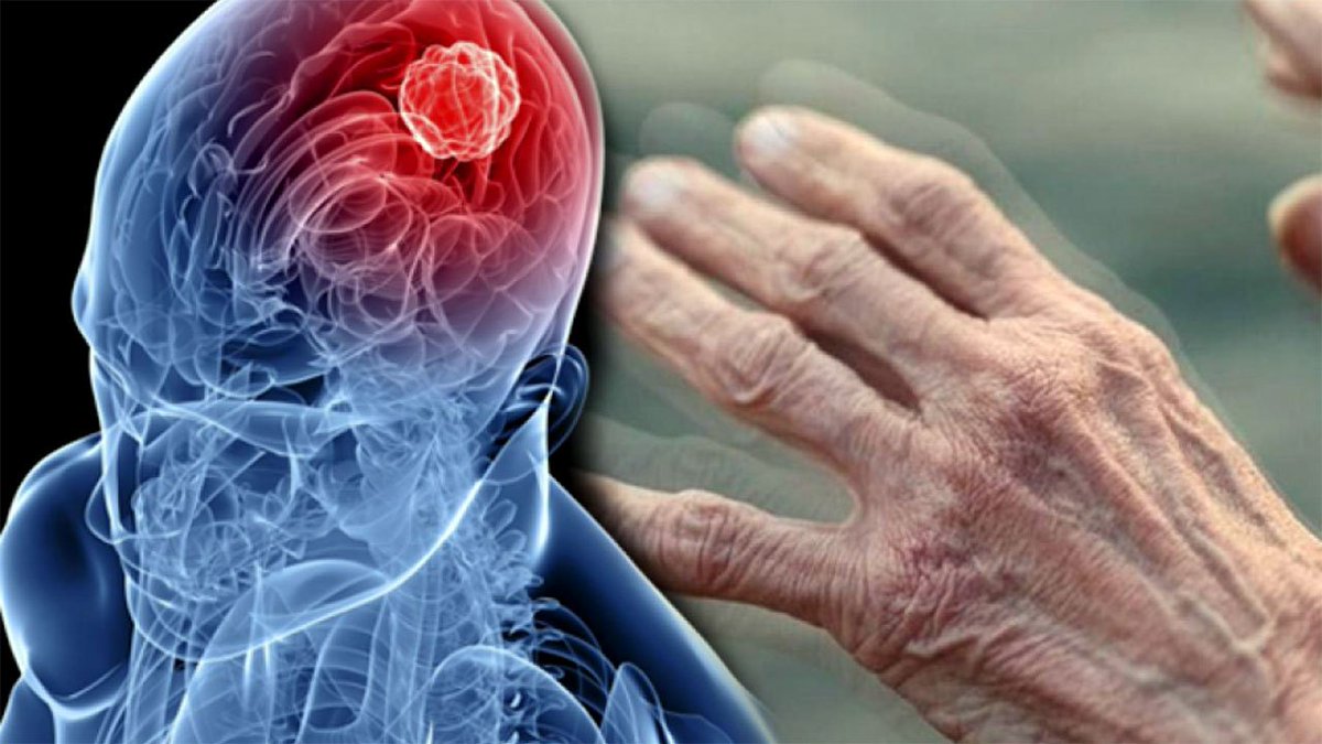 GELECEKTE ARTMASI BEKLENEN HASTALIKLARIN ERKEN UYARI İŞARETLERİ

1) Nörodejeneratif Hastalıklar (Alzheimer, Parkinson, Demans)

Erken Uyarı İşaretleri:
— Sürekli beyin sisi
— Yeni bilgileri unutmada artış
— Odaklanmada zorlanma
— Koku duyusunda zayıflama
— El titremesi, ince