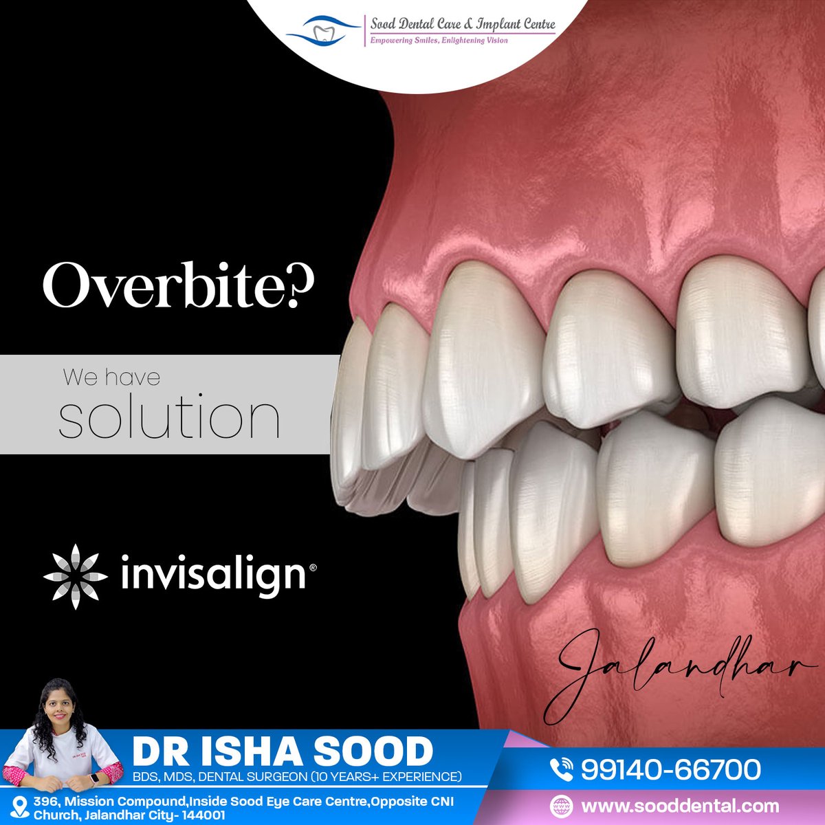 sooddental's tweet image. Overbite affecting your smile or bite?
Don’t worry we have a solution with Invisalign
Straighten your teeth comfortably without metal braces.
Sood Dental Care &amp;amp; Implant Centre, Jalandhar
Dr. Isha Sood  BDS,MDS(10+ Years Experience)
#Overbite #Invisalign #ClearAligners #DrIshaSood