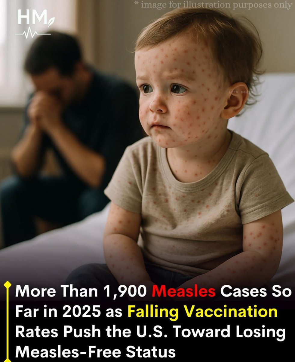 kacdnp91's tweet photo. The propaganda is strong. Even the t-shirt has measles. 😑 https://t.co/0Hdp9gm9MQ