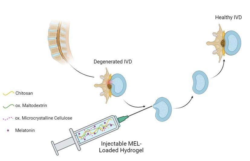 Q1 Aralık 2025 yayınımız; Bel fıtığına sebep olan intervertebral disk dejenerasyonuna yönelik geliştirilen yenilikçi enjekte edilebilir hidrojel.

▶Tam erişim için: authors.elsevier.com/c/1mDdg_3ENNVw…

<a href="/baruedutr/">Bartın Üniversitesi</a>  <a href="/profdraakkaya/">Prof. Dr. Ahmet AKKAYA</a> 
#biyomalzeme #dokumühendisliği #belfıtığı #diskrejenerasyonu