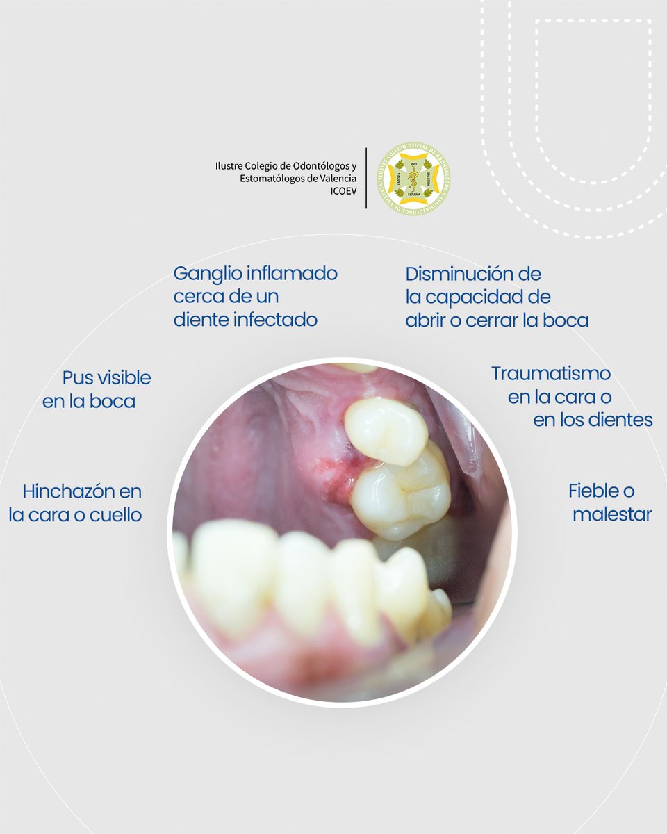 Sentir #dolorbucodental nunca es normal y casi siempre significa que hemos llegado tarde. 

En el carrusel encontrarás los síntomas clave que requieren atención inmediata: desde hinchazón, fiebre o pus, hasta dificultad para abrir la boca o un traumatismo en los dientes