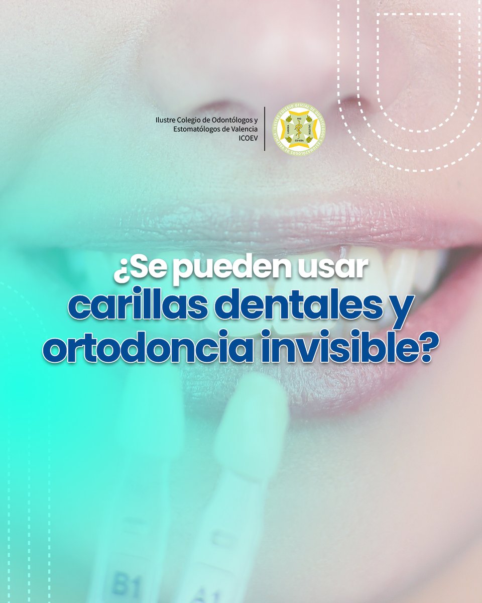 Aunque puede sonar tentador, no es posible realizar un tratamiento de ortodoncia y carillas a la vez. 
Tal y como explica la @aesoroficial, primero es imprescindible alinear los dientes con ortodoncia para lograr la posición correcta