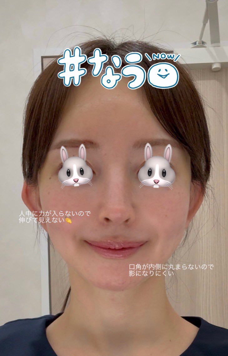 𝐲̆̈子ちゃん tweet media