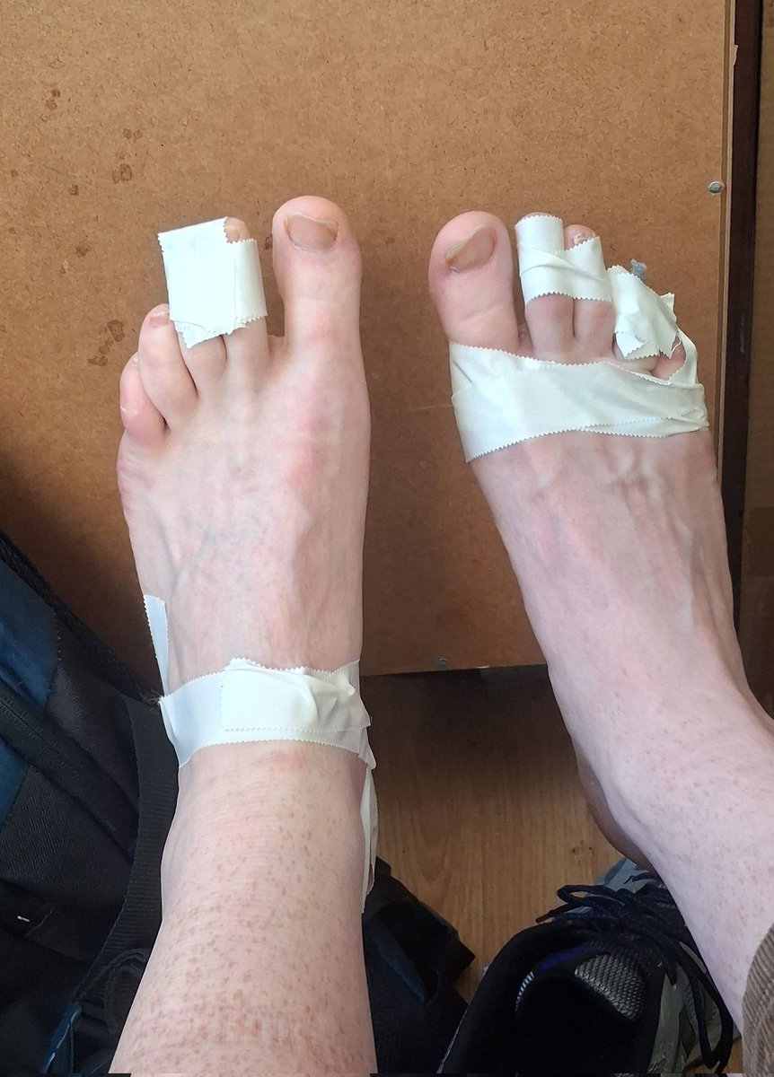the_metalhippie's tweet photo. Got my blisters taped up, ready to rock. #feettweet #feetpic https://t.co/57CfUnPWSH