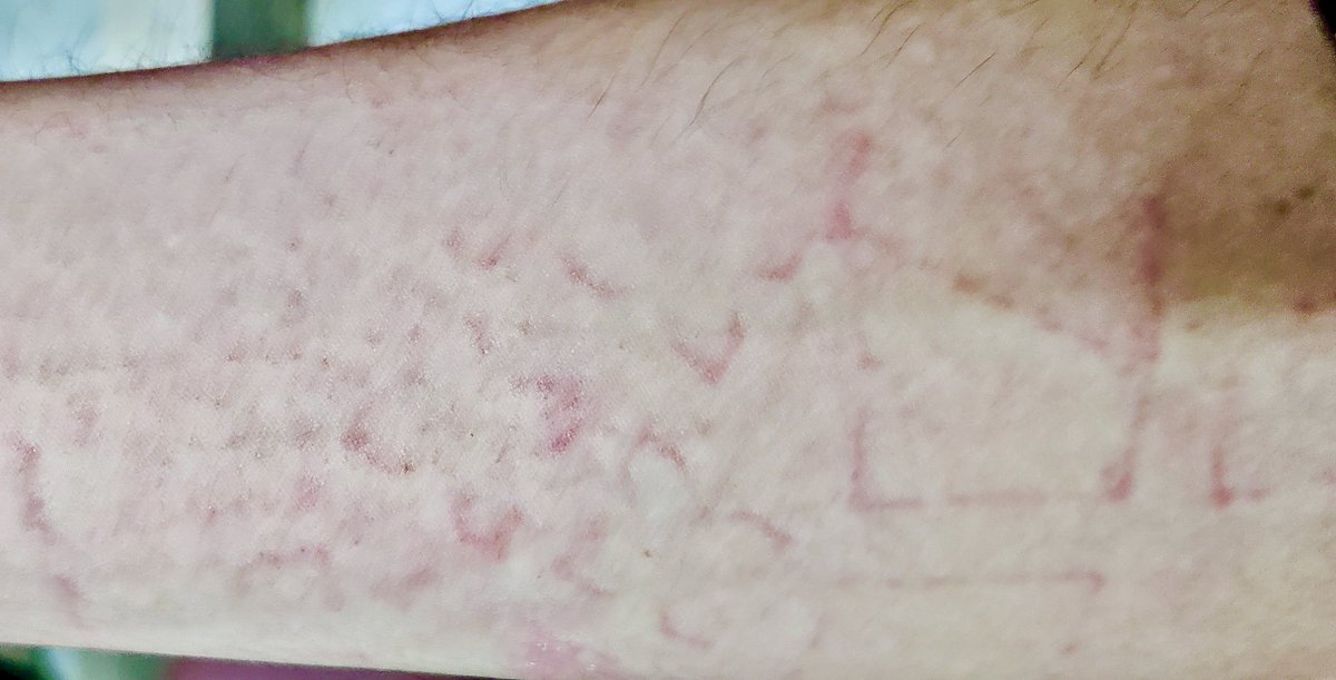 dm_suby's tweet image. 被踩出三朵花🌸
#男m #女s #踩踏 #恋足 #踩射 #鞋底 #上海 #调教 #现实 #女王 #踢裆 #乘骑 #舔鞋 #狗奴 #鞋印 #sm #女主 #字母