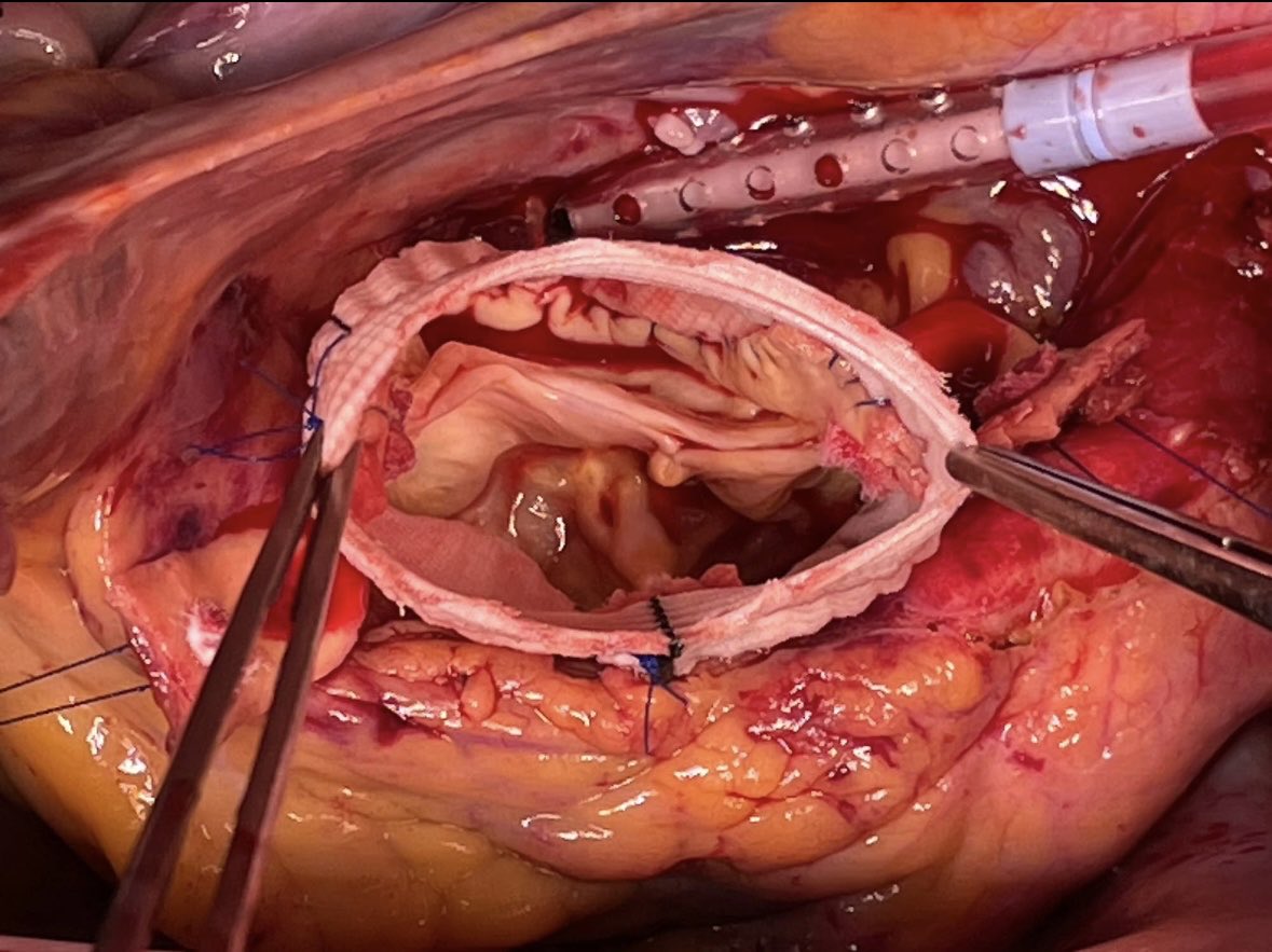 Stephane Leung, MD MSc FRCSC tweet media