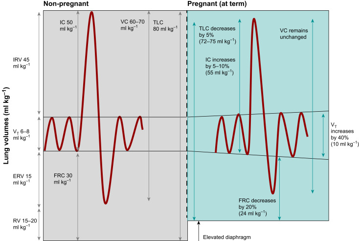 BJAJournals's tweet image. Why does pregnancy make hypoxia so dangerous? 🤔🫁
• BMR ↑ up to 15%
• O₂ consumption ↑ ~20%
• FRC ↓ ~20% at term
The result: rapid desaturation at induction and during cardiac arrest.
bjaed.org/article/S2058-…