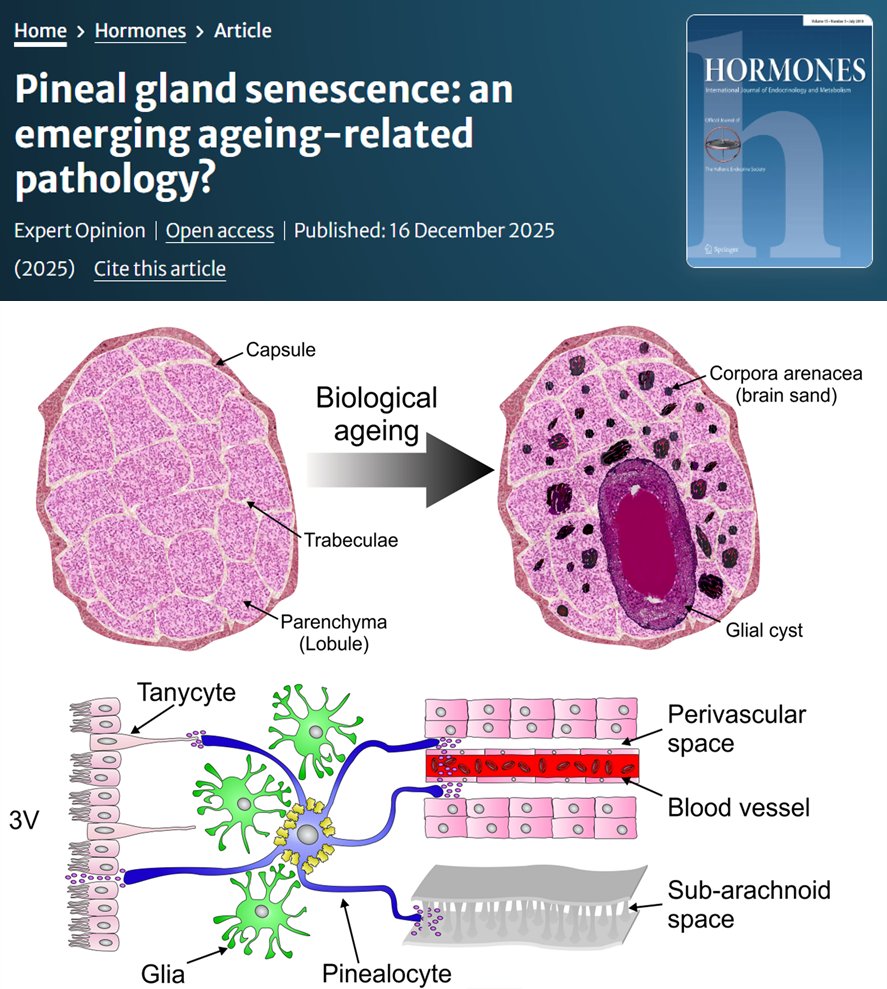 bbentley_1's tweet photo. 🧠 Is pineal gland senescence an ageing-related pathology?

In this new paper @ICCARP_org review human evidence of structural and functional changes of the pineal gland with age.

📄https://t.co/ixYEjyXsBV

#Ageing #Aging #CircadianBiology #Geroscience #Hormones #Senescence https://t.co/EaY7KU6UGm