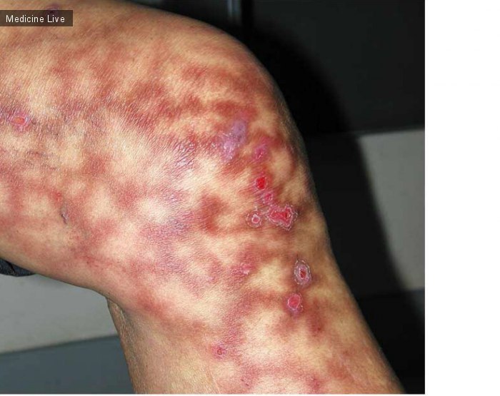 What is the description or diagnosis?