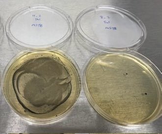 <a href="/thegarybrecka/">Gary Brecka</a> You can also use our biotech nano lipid toothpaste to directly remove P. Gingivalis which is the main cause of VSC ( volatile sulfur compounds) aka bad breath ! We also select for S. Mutans which causes cavities. I reduced mine by 99.9% in 8 days!