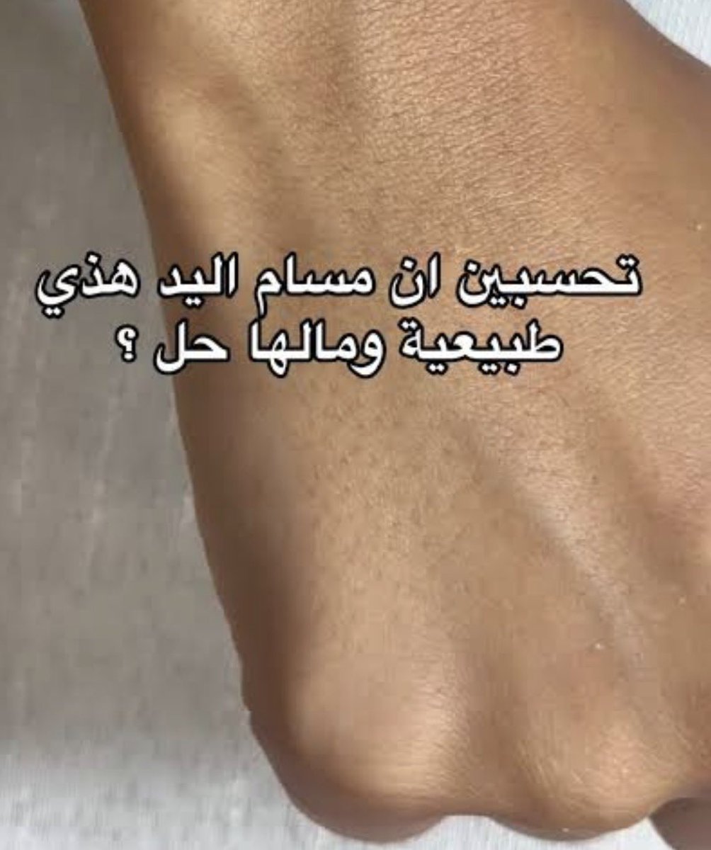 عندك مناسبة قريبة ومتفشلة من منظر يدك ؟
" بعطيك الحل تحت هالتغريدة وابيك تدعينلي بس "