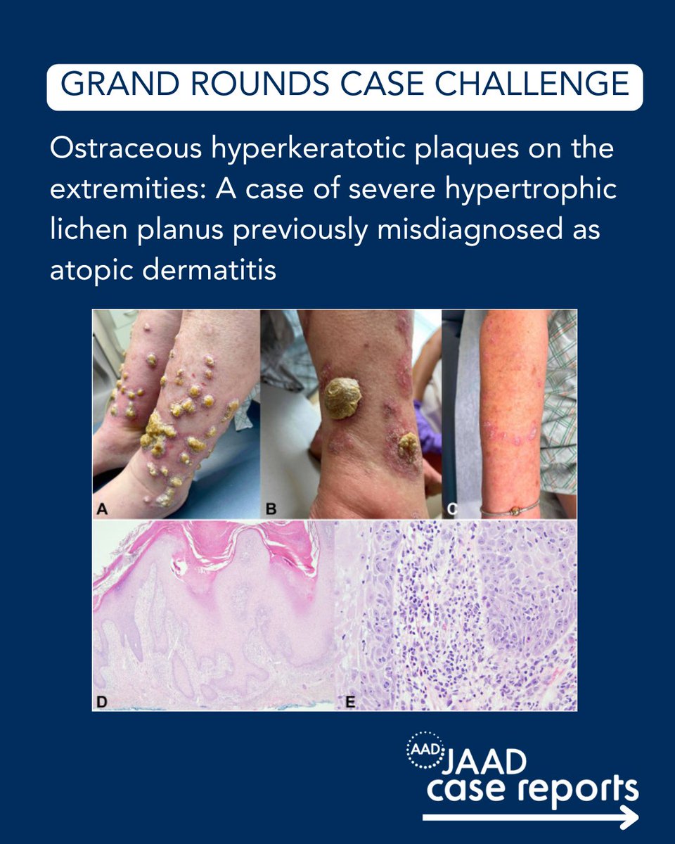 JAAD Journals tweet media