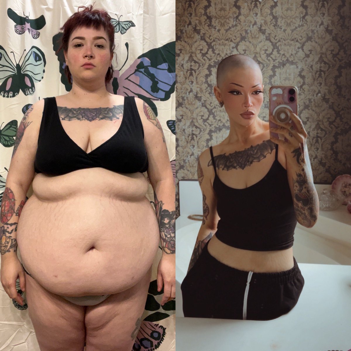 homegrownmania's tweet image. 2023 vs. 2025
310 vs. 148
You can be beautiful at any weight but I was miserable, in pain, and not able to be the mother my kids deserved. I will never forget taking these before pictures and sobbing.