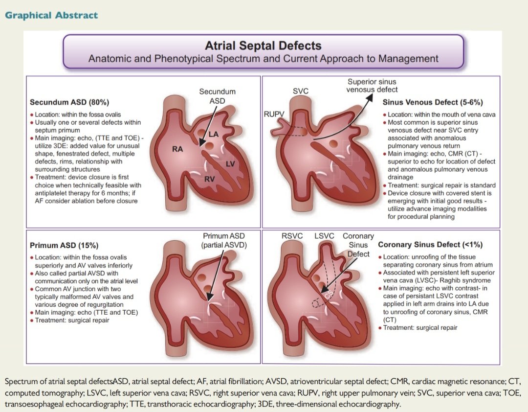 javier20ch's tweet image. Comunicación interauricular. 🫀💥
♦️Es la cardiopatía congénita más frecuente diagnosticada en la edad adulta (~25–30%).📊❤️‍🩹
♦️Aunque es un defecto “simple”, su evolución no tratada se asocia a arritmias auriculares, falla derecha, tromboembolismo y, en algunos casos,…