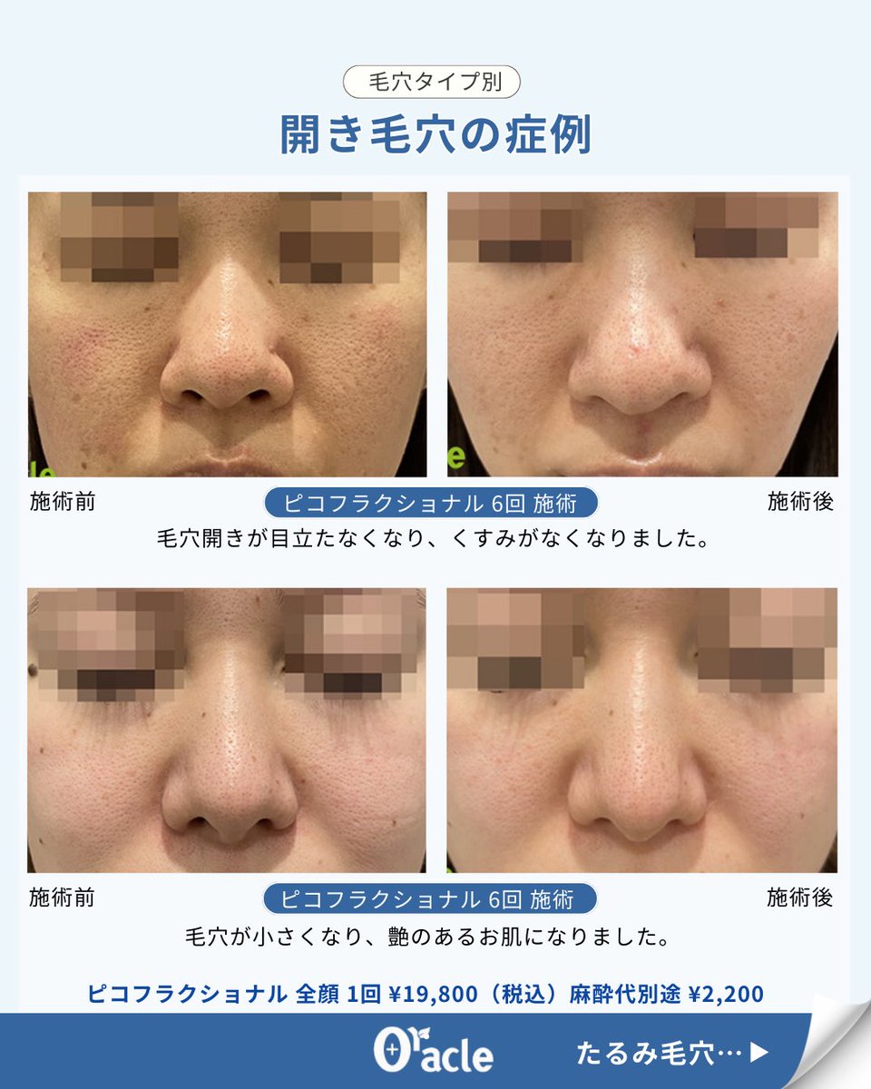 オラクル美容皮膚科【公式】 (@oracleclinic) / Posts / X