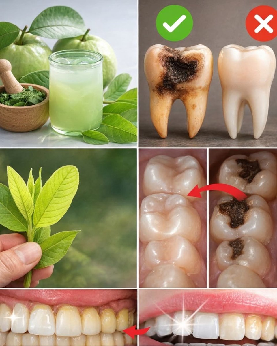Herbalisque's tweet photo. 🦷 Tooth decay doesn’t start overnight—and neither does healing. Before cavities get worse, many people use guava leaves, a simple and affordable traditional remedy, to support oral health. Here’s how 👇 https://t.co/sAIqRFeW6q
