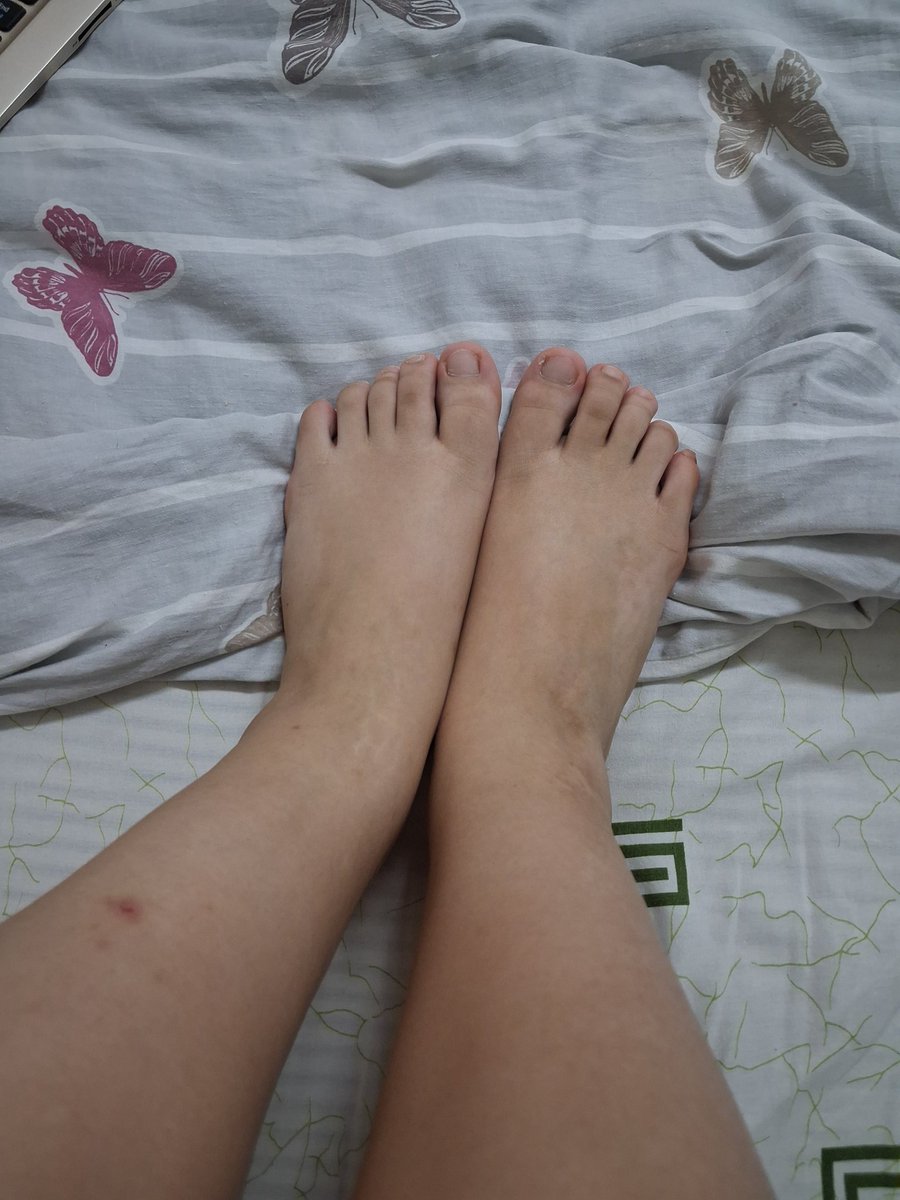 FeetMaster07's tweet photo. Do you like raw feet? #rawfeet #feetlover #ilovefeet #feetlover #feetcontent #playwithfeet #feetfetish https://t.co/c3HwZ3RMCc