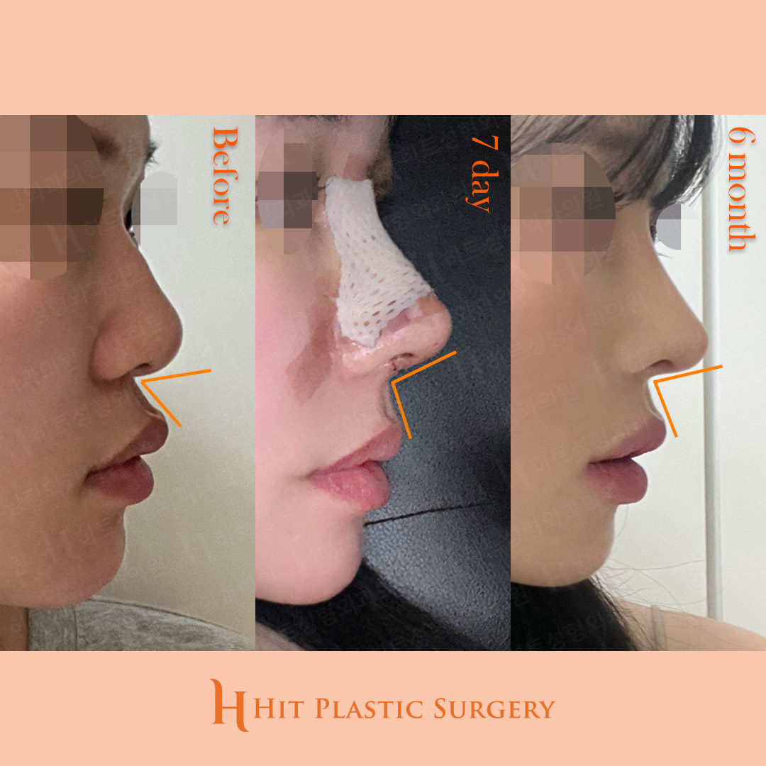 ヒット整形外科 tweet media