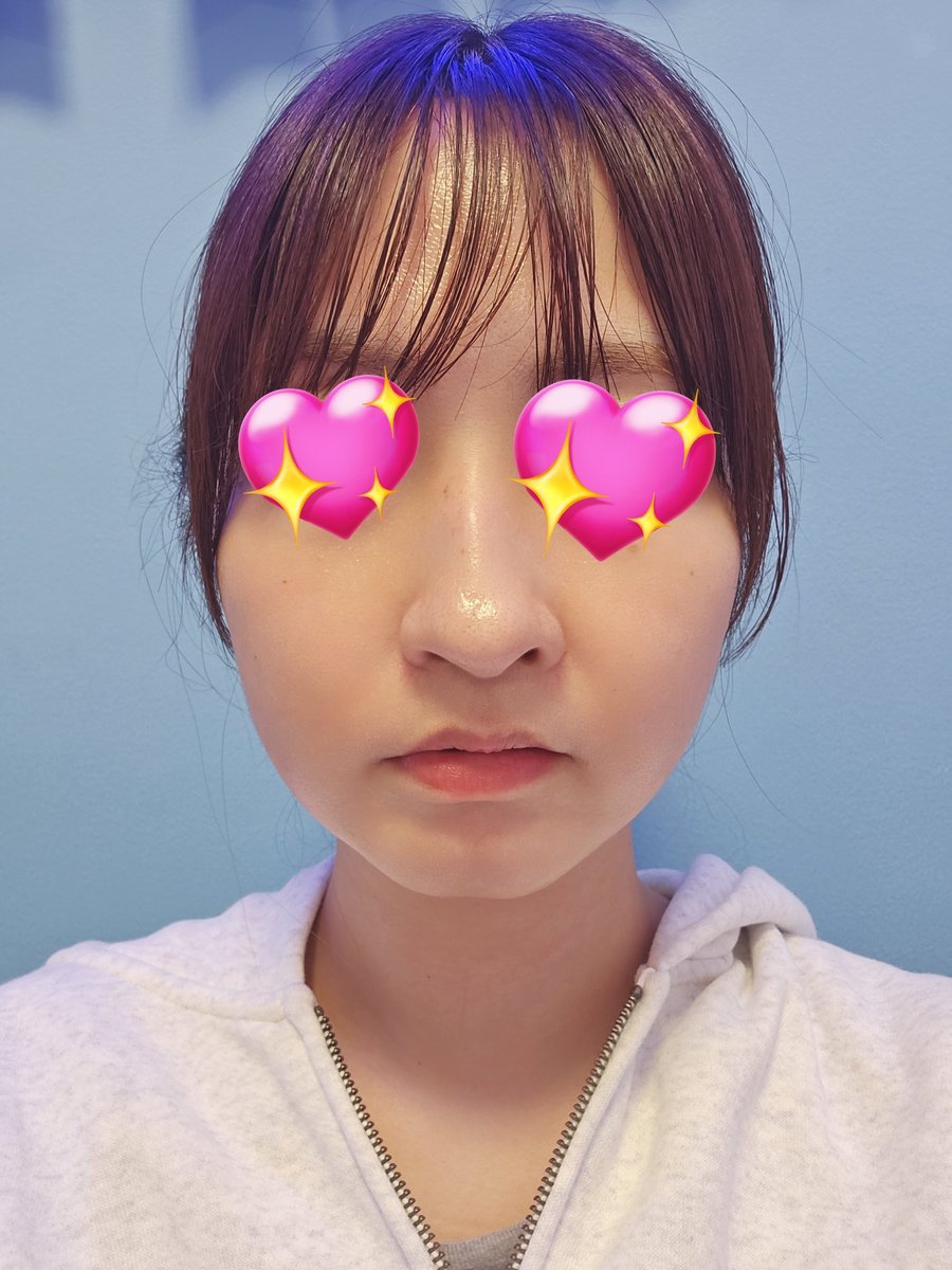 non_kyousei's tweet photo. 髪型違うから参考にならないか…？
左が今日、右が6日前！ https://t.co/dxGp5Q0oLQ