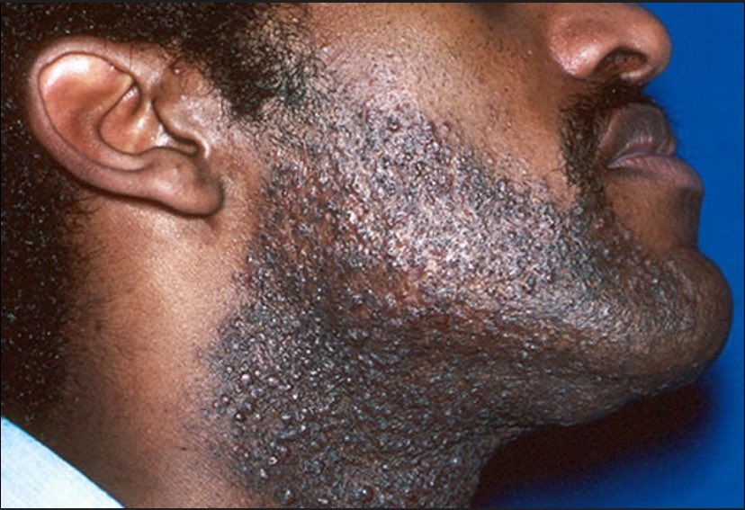 oluwa_crystal's tweet image. Please what is the permanent solution to this ?