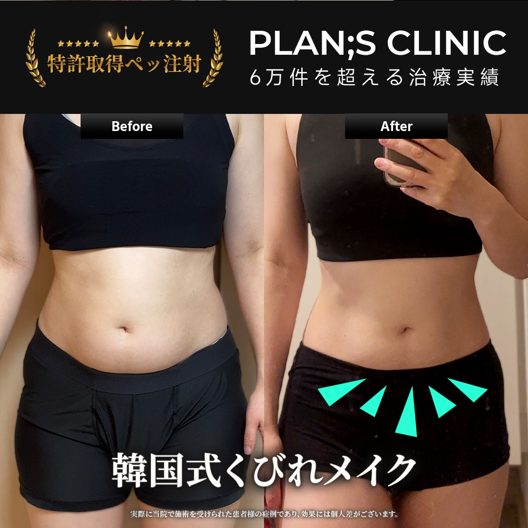 プランエスクリニック（強め）新品未使用 公式】プランエスクリニック（PLAN;SCLINIC） (@plansjp) / Highlights / X