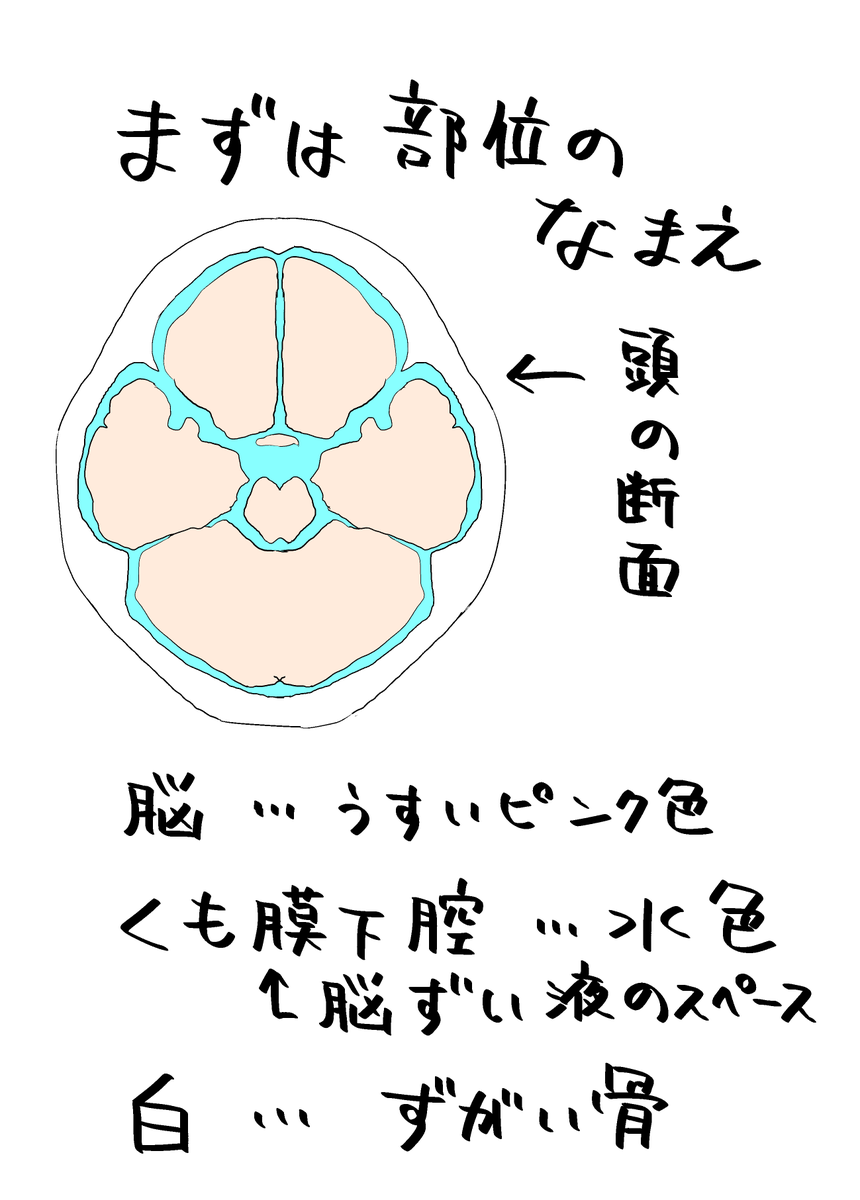 ブレイキングダウンの「くも膜下出血」という語句に振り回されてる一般の方むけに解説を書きちらしました 