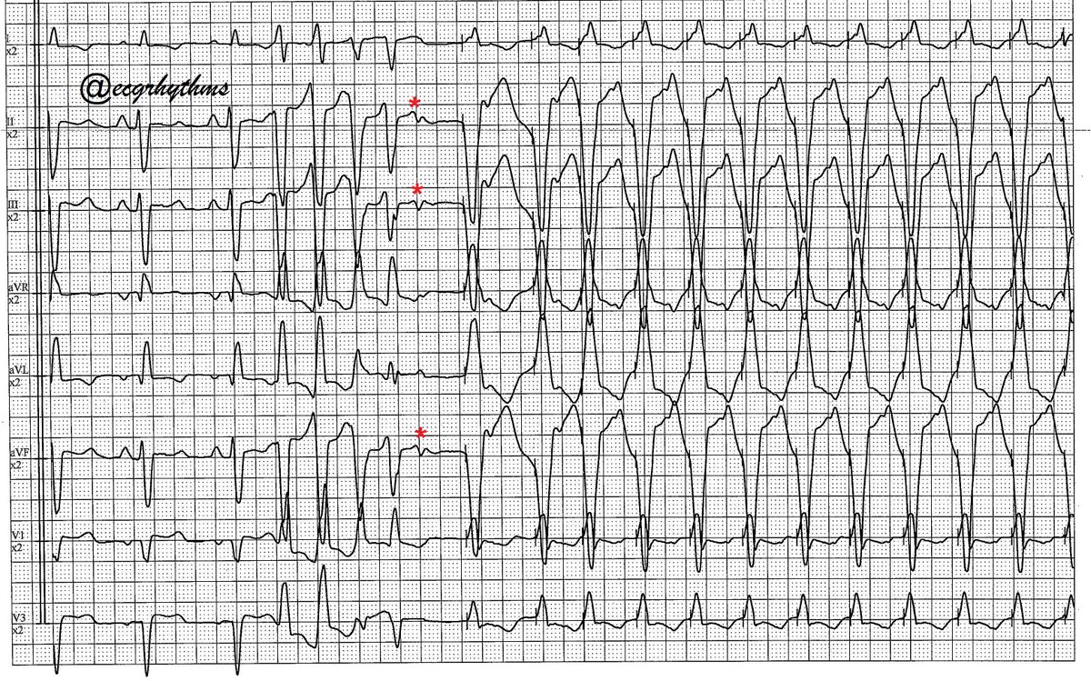 Arnel Carmona tweet media