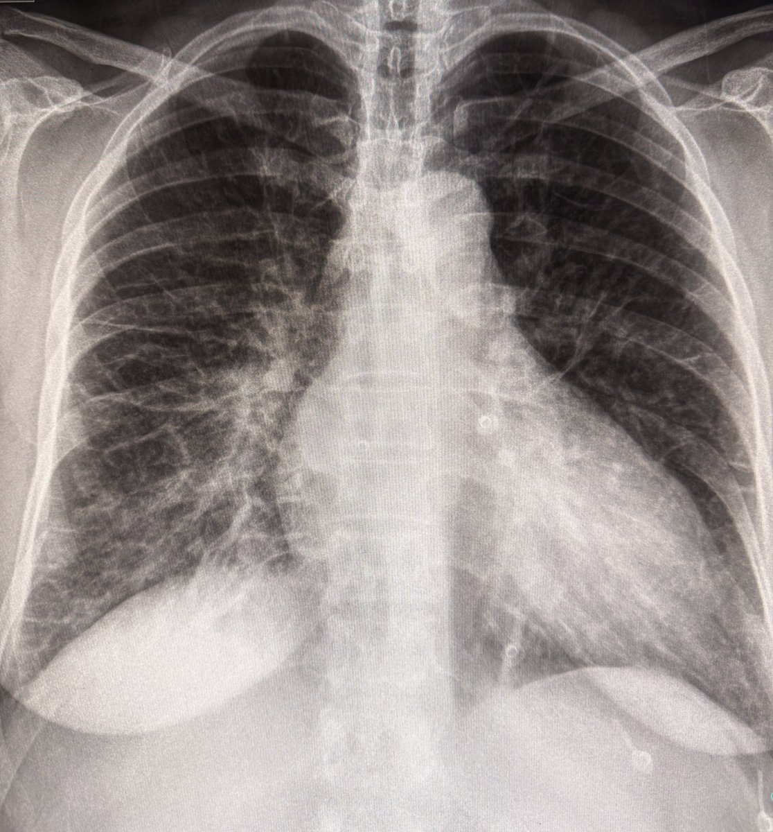 Sameer Raniga tweet media