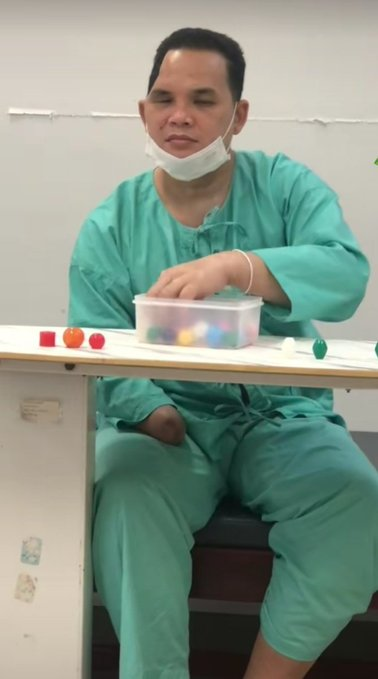 กองทัพ อย่าทิ้งทหารพาน ท่านนี้ สงสารเขามาก สู้รบกับเขมร จนพิการ ตลอดชีวิต ต้องกายภาพบำบัด เรียนรู้ใหม่หมดเลย พี่เขาชื่อ อนันต์ เชื้อด้วยผุย   

#ชายแดนกัมพูชา #ชายแดนไทยเขมร #โหนกระแส #ปราสาทตาควาย  #ทหารไทย