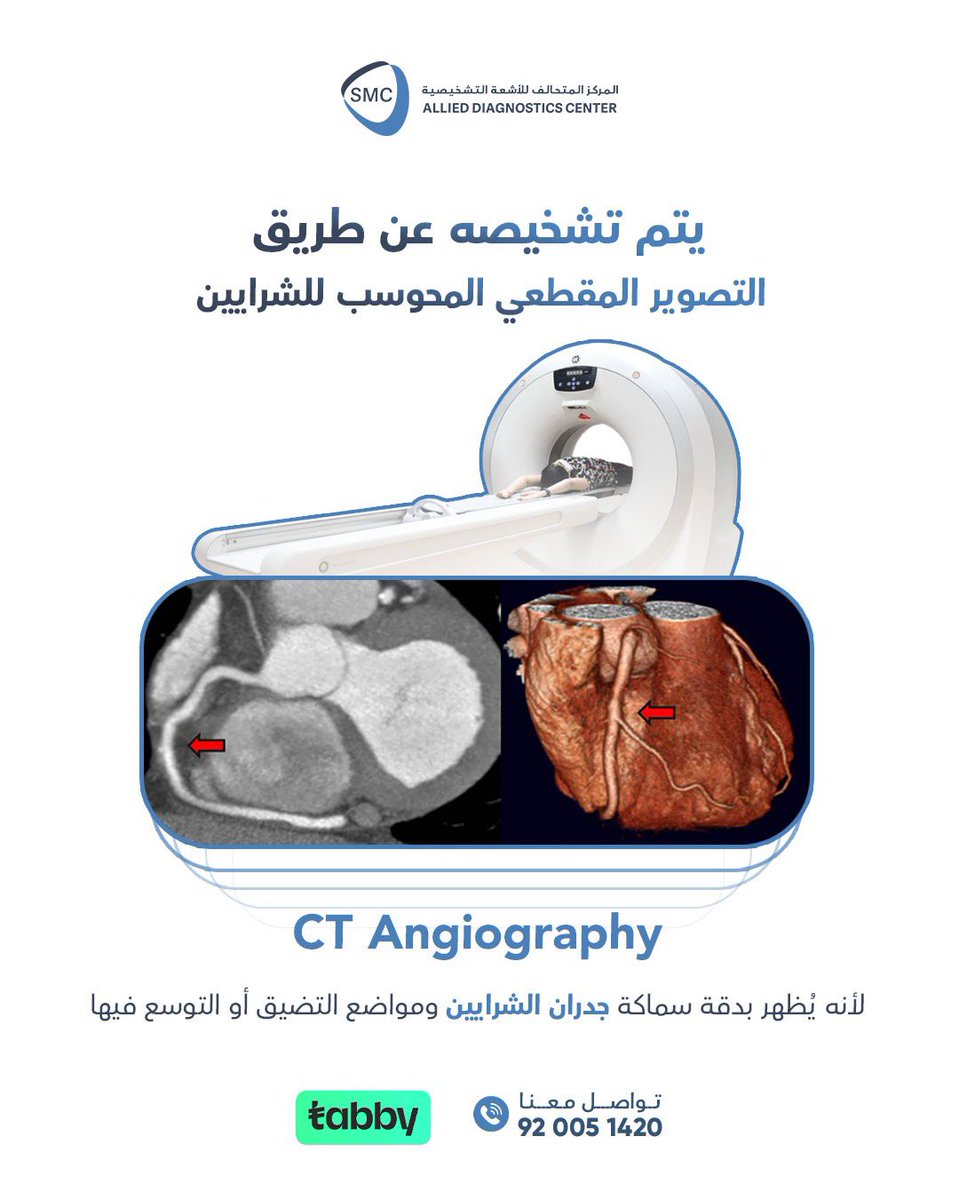 ADC__KSA's tweet photo. هل سمعت من قبل عن التهاب تاكاياسو المعروف بمرض انعدام النبض؟ 

#تشخيص_دقيق_بتقنية_حديثة https://t.co/2HvBEiJGSq