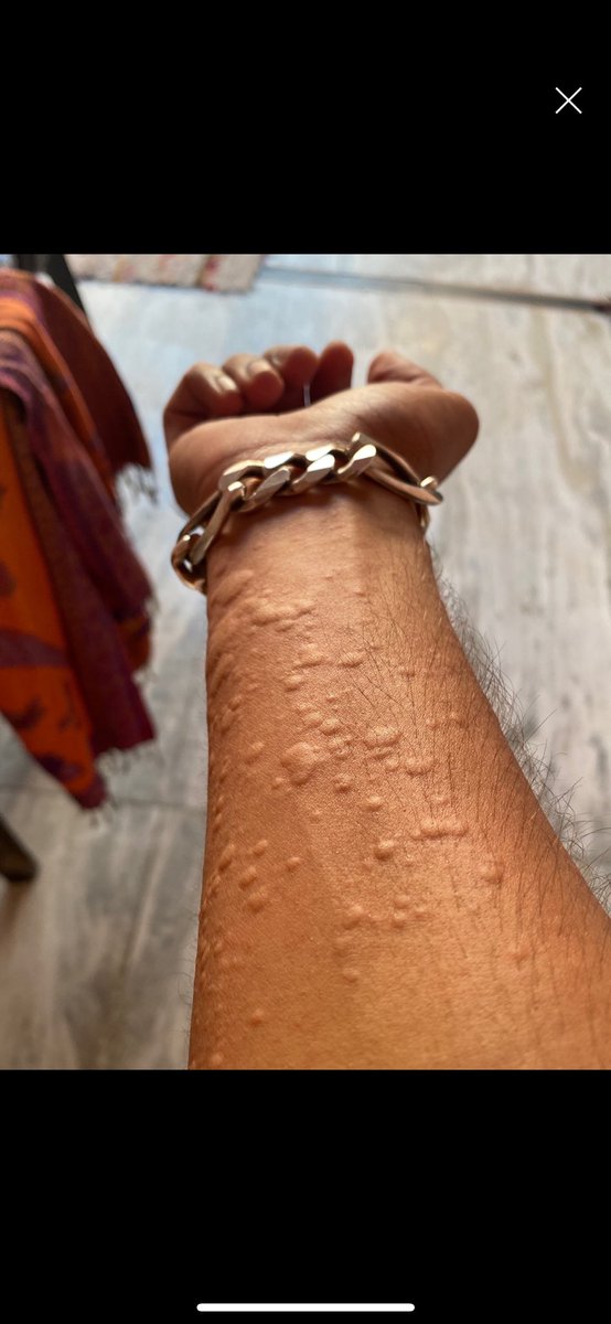 Vocês sabem o que causa isso?