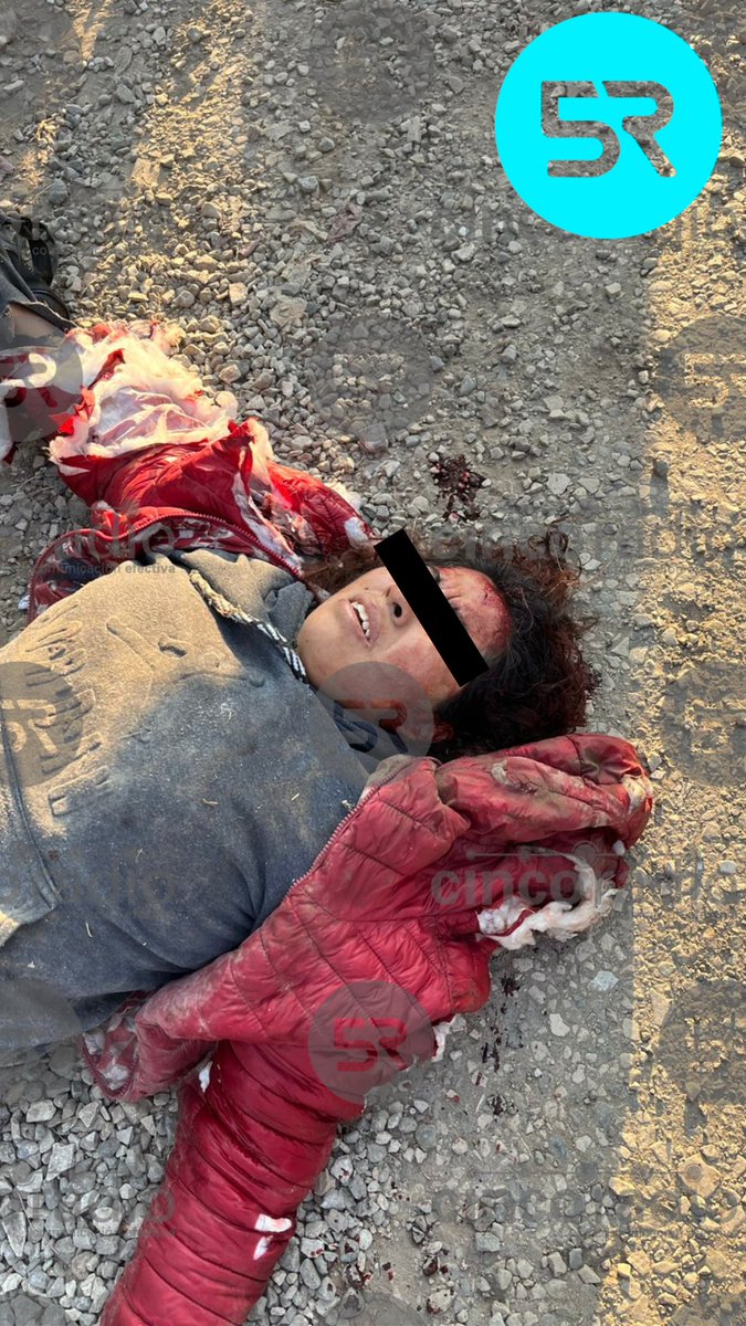 #ÚLTIMAHORA 🚨🐕 || Se reporta que múltiples perros callejeros atacaron a una mujer en el Andador Industrial, entre calles Morelos y Vicente Guerrero, en Cuautlancingo. Urge una ambulancia, ya que la atención médica inmediata es necesaria.