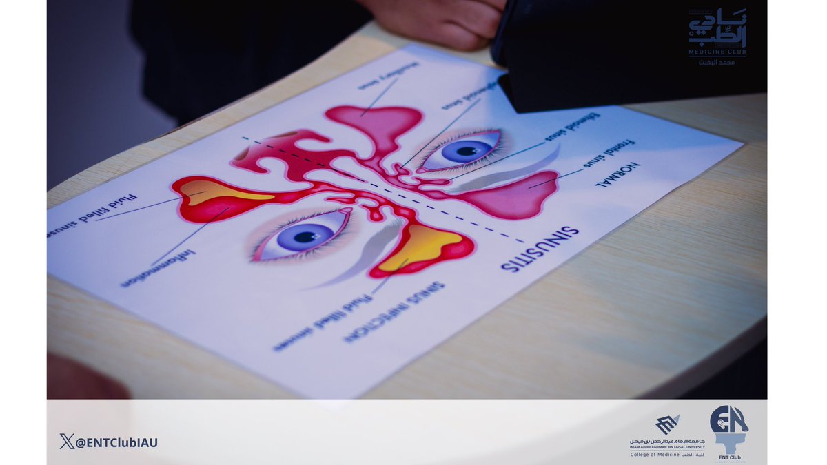 ENT Club tweet media