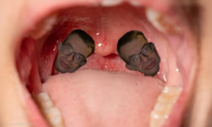 Got abit of a sore throat, hope im not getting Bonkilitis