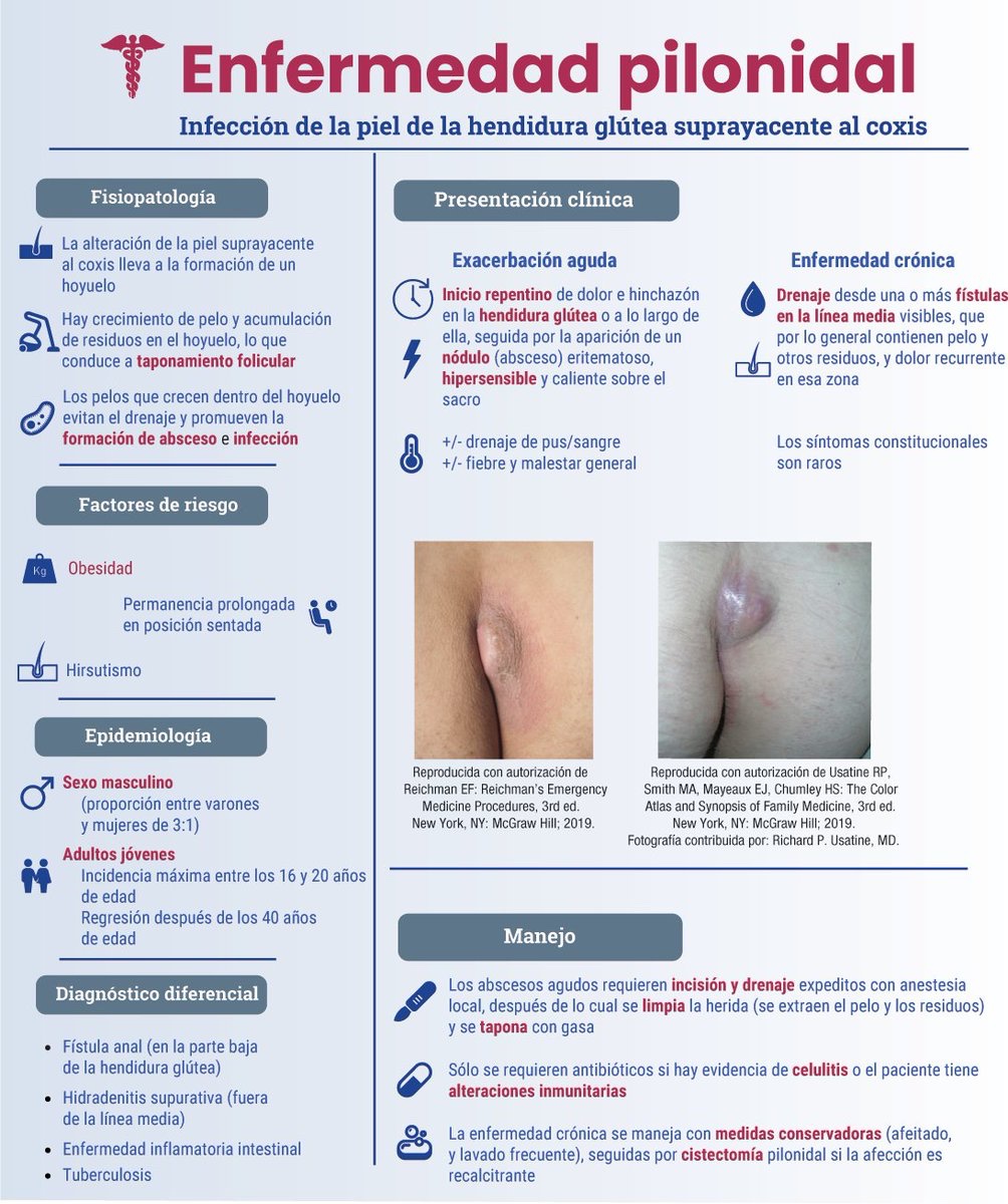 Tórax - Mama : anatomía normal | e-Anatomy, image size:1004x1200