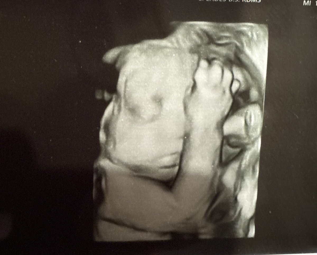 Andy Harrison tweet media