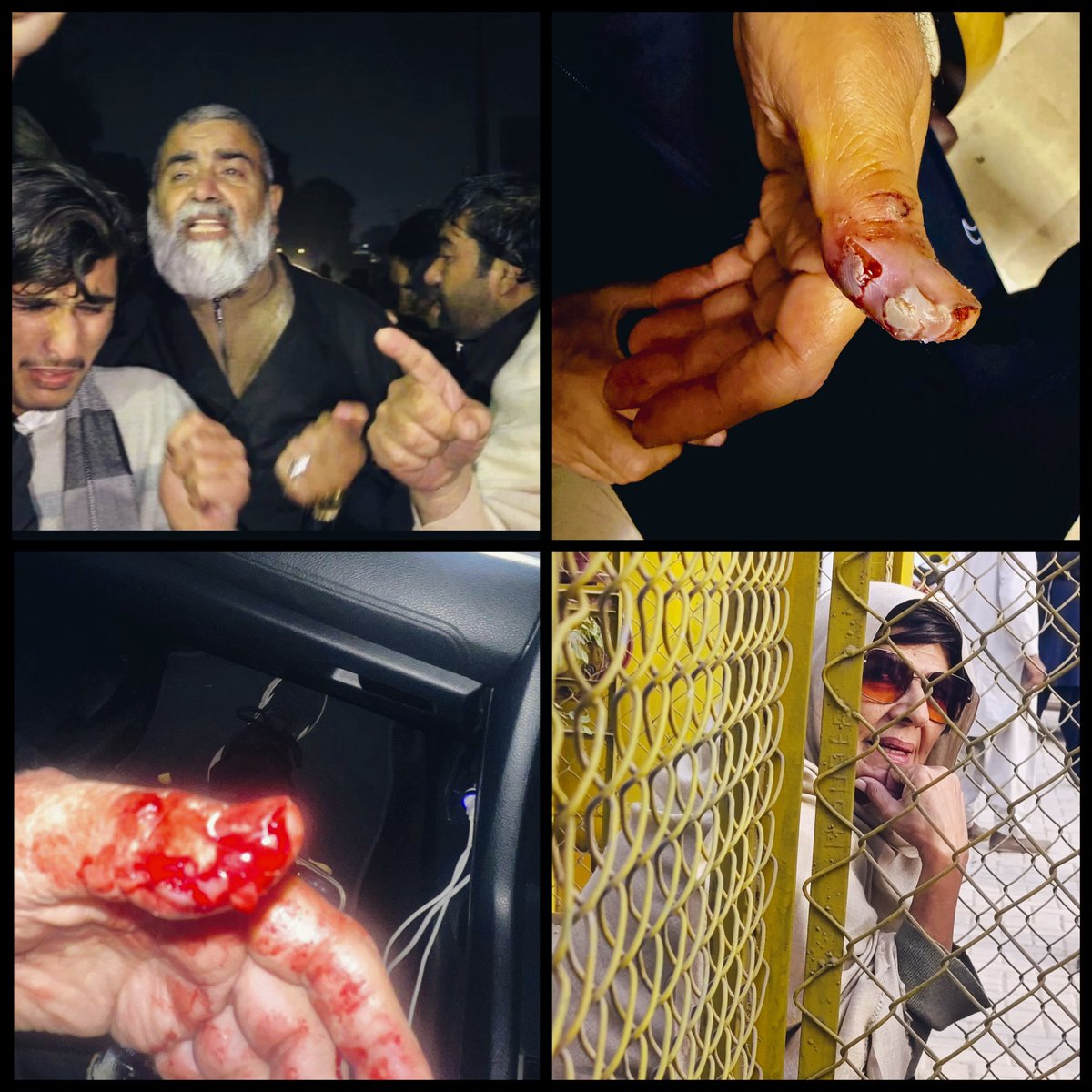 We condemn in the strongest possible terms the repeated acts of brutality inflicted on peaceful protesters outside Adiyala Jail, led by Aleema Khan, as they lawfully demanded justice and their fundamental rights of meeting Imran Khan. For the second time in recent days,
