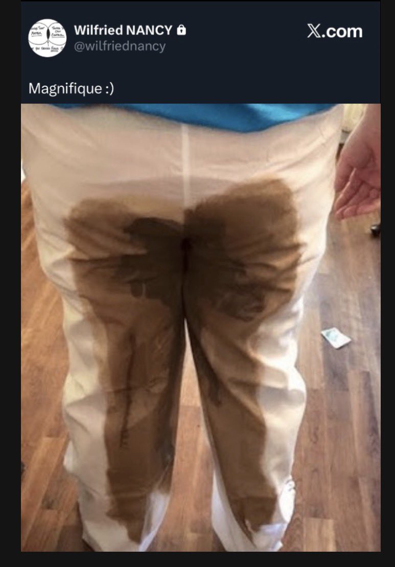 𝐃𝐈𝐆𝐁 tweet media