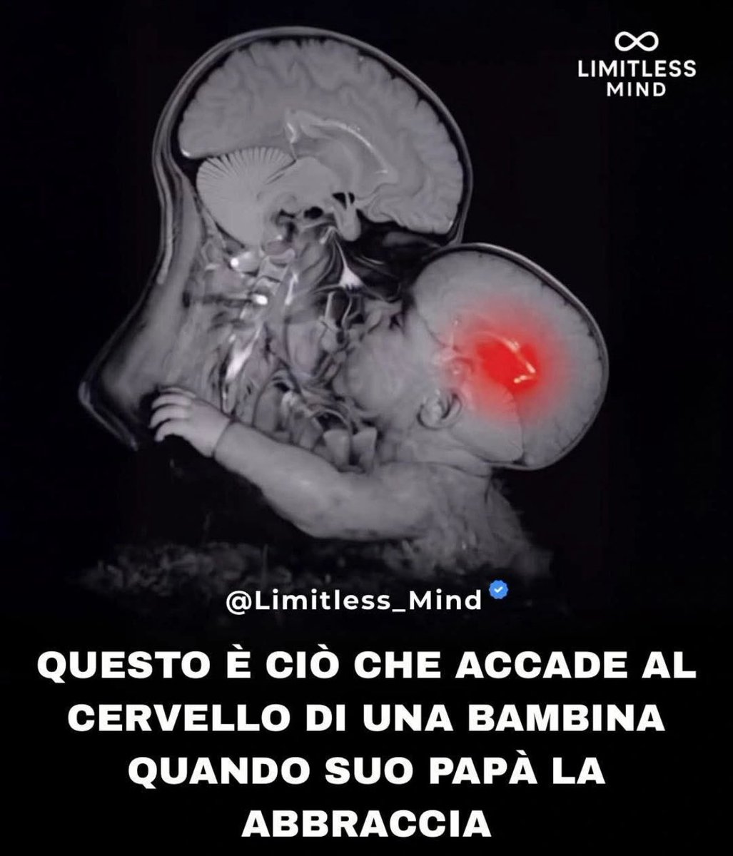 Frenkie_Woody's tweet photo. La presenza o l’assenza della figura paterna lascia davvero un segno nel cervello di una bambina.
Non perché senza papà sia “fragile”, ma perché quando c’è un padre presente e affettuoso, il cervello si rafforza in modo molto specifico.

Ogni volta che un papà abbraccia sua figlia, il cervello della bambina rilascia ossitocina, l’ormone del legame e della sicurezza.
Quell’abbraccio invia un messaggio profondo al sistema nervoso:
“Sono al sicuro. Ho valore. Posso fidarmi.”

Quando quegli abbracci mancano, molte bambine imparano a proteggersi da sole troppo presto.
Non sempre lo dicono.
Non sempre si nota.
Ma il corpo e il cervello lo registrano.

Con abbracci costanti, lo stress diminuisce, la paura si regola e il cervello impara a sentirsi calmo.
Una bambina che si sente protetta pensa meglio, dorme meglio e osa di più.

Con il tempo, quegli abbracci costruiscono una vera autostima:
non quella che si proclama a voce alta, ma quella che si sente dentro.
La bambina impara che merita rispetto, che i suoi confini contano e che l’amore non fa male.

Studi sullo sviluppo infantile mostrano che le bambine con figure paterne presenti e affettuose tendono ad avere:
• Maggiore sicurezza emotiva
• Migliore gestione delle emozioni
• Meno paura dell’abbandono
• Maggiore chiarezza nel porre dei limiti
• Più fiducia nelle proprie decisioni e relazioni

Un papà non educa solo pagando le bollette.
Educa quando è presente.
Quando ascolta.
Quando abbraccia.

Perché a volte un abbraccio di papà non cambia solo il momento…
cambia il modo in cui una bambina vede se stessa per il resto della sua vita.