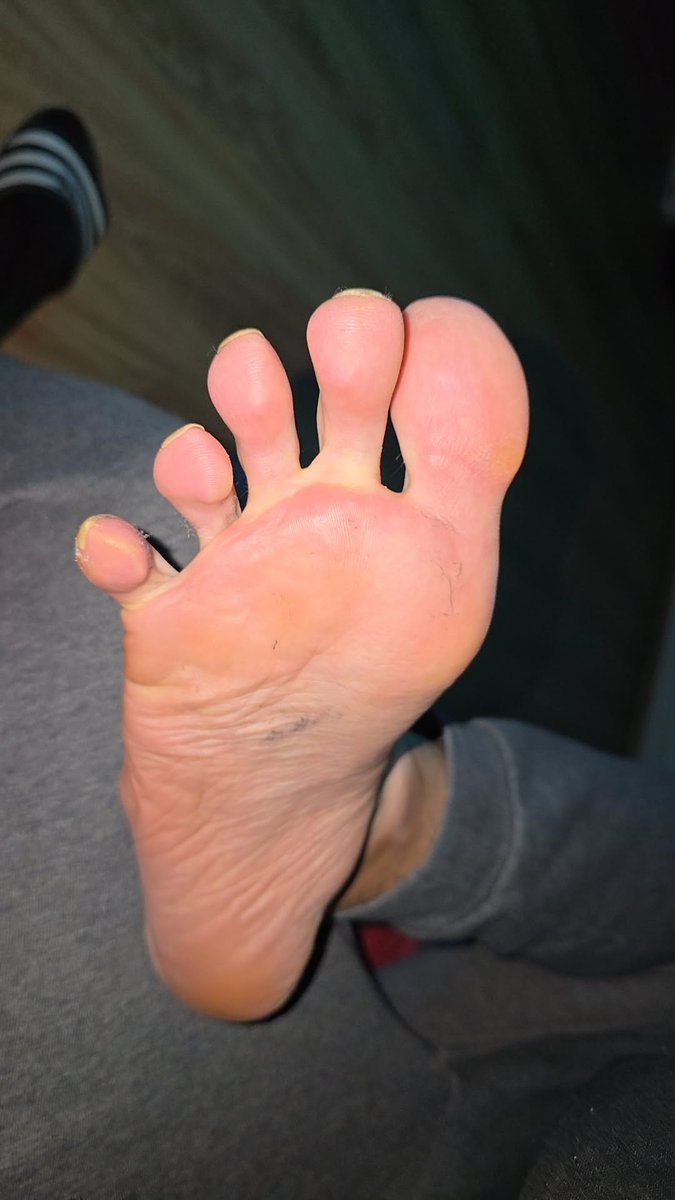 YoungBoyFeet44's tweet photo. Wie es wohl zwischen meinen Zehen riecht? #füße #feet https://t.co/OtFzrGtNgH