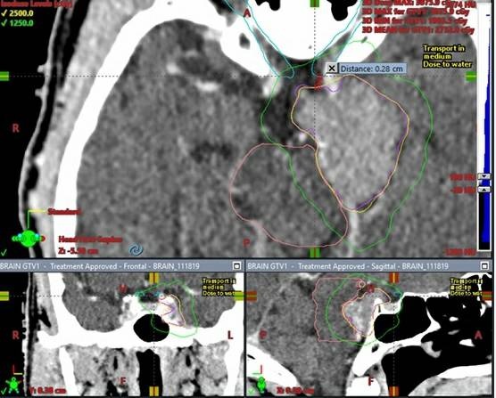 Journal of Neuro-Oncology tweet media