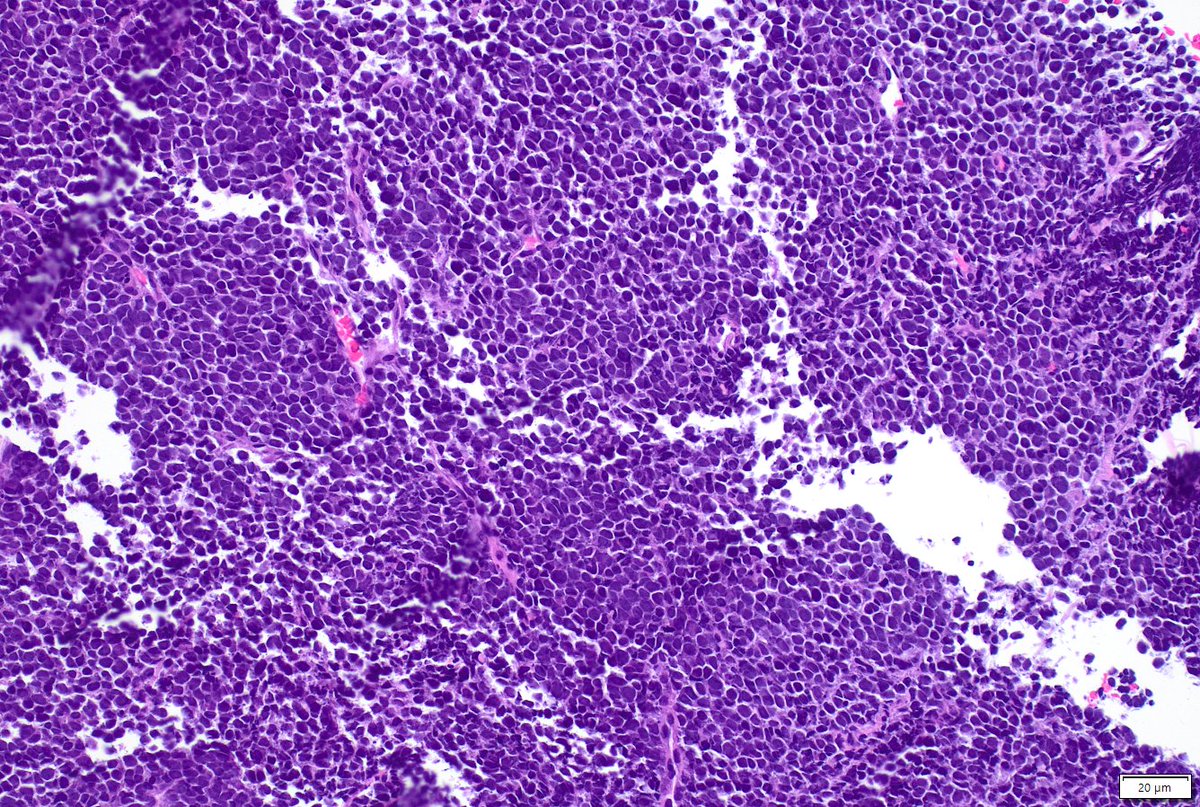 Humberto Trejo Bittar, MD, FCAP tweet media