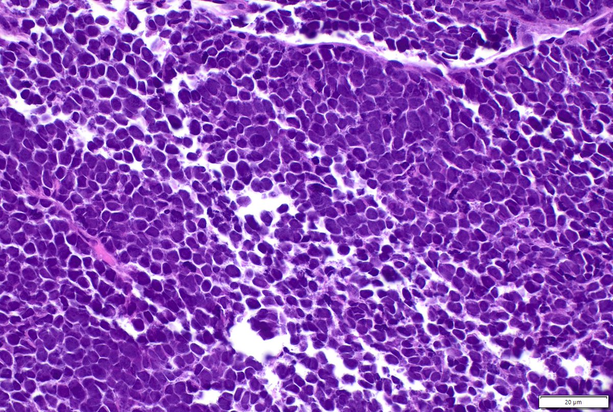 Humberto Trejo Bittar, MD, FCAP tweet media