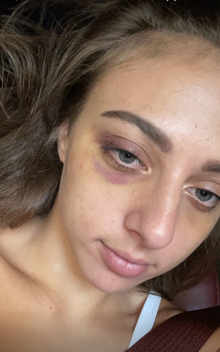 giaderza69 tweet media